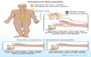How Mercury in Cancer Happens 5 Key Causes You Should Know